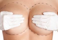 Totul despre implanturile mamare